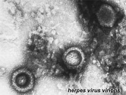 herpes